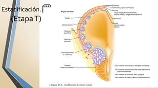Estadificación. 🚥
(EtapaT)
 