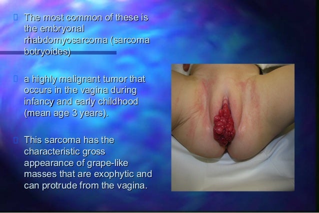 Foto vagina