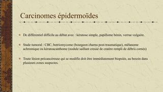 Carcinomes épidermoïdes
Dc différentiel difficile au début avec : kératose simple, papillome bénin, verrue vulgaire.
Stade tumoral : CBC, botriomycome (bourgeon charnu post-traumatique), mélanome
achromique ou kératoacanthome (nodule saillant creusé de cratère rempli de débris cornés)
Toute lésion précancéreuse qui se modifie doit être immédiatement biopsiée, au besoin dans
plusieurs zones suspectes.
 