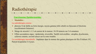 Radiothérapie
Carcinome Epidermoide:
• Modalités :
La radiothérapie externe :
photons X de faible ou forte énergie, rayons gamma (télé cobalt) ou faisceaux d’électrons
(accélérateurs linéaires).
Marge de sécurité 1-1.5 cm autour de la tumeur. 10-30 séances sur 3-6 semaines
Effets secondaires aigus : épidermite, réversible. Tardifs irréversibles : atrophie, dyschromie,
sclérose cutanée, second cancer sur la zone irradiée.
La curiethérapie interstitielle : Implanter dans la tumeur des gaines plastiques de fils d’iridium 192.
Patient hospitalisé 3-4 jours.
 