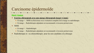 Carcinome épidermoïde
Haut risque
Exérèse chirurgicale avec une marge chirurgicale large(> 6 mm) :
Si marge + : MMS ou Réexerese avec évaluation complète de la marge ou radiothérapie
Si marge - : Radiothérapie adjudante est recommandé si invasion perinerveuse
MMS
Si marge + : Radiothérapie
Si marge - : Radiothérapie adjudante est recommandé si invasion perinerveuse
Radiothérapie et / ou chimiothérapie pour les non candidats à la chirurgie
 