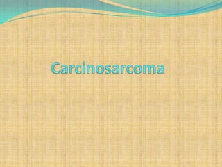 Carcinosarcoma 1 