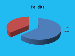Pel dits



           PRESENT

           ABSENT
 