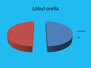 Lòbul orella


               ENGANXAT


               SOLT
 
