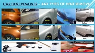 CAR DENT REMOVER – ANY TYPES OF DENT REMOVE
 