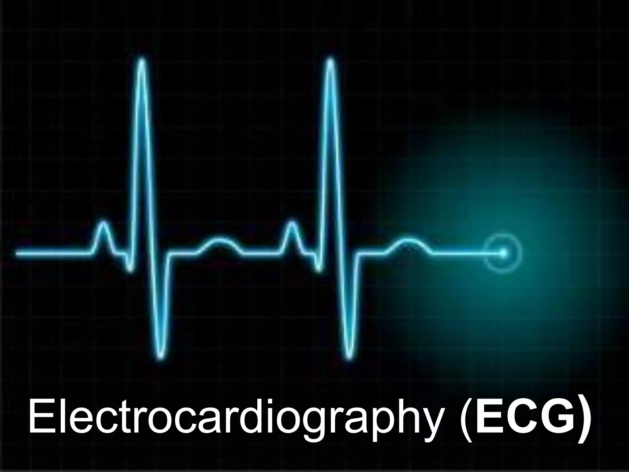 Electrocardiography (ECG)
 