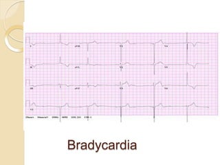 Cardiac function-test | PPTX