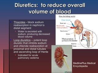 Diuretics:  to reduce overall volume of blood Thiazides  - block sodium reabsorption in nephron’s distal segment Water is excreted with sodium, producing decreased blood volume Loop diuretics  – potent loop diuretic that inhibits sodium and chloride reabsorption at proximal and distal tubules and ascending loop of Henle Indicated for acute pulmonary oedema MedlinePlus Medical Encyclopedia 