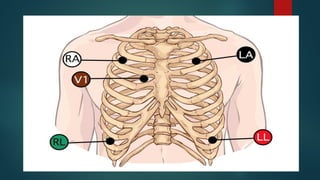 Cardiac-Monitor-Equipment-Presentation.pptx