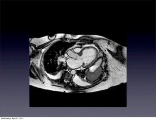 Wednesday, April 27, 2011
 