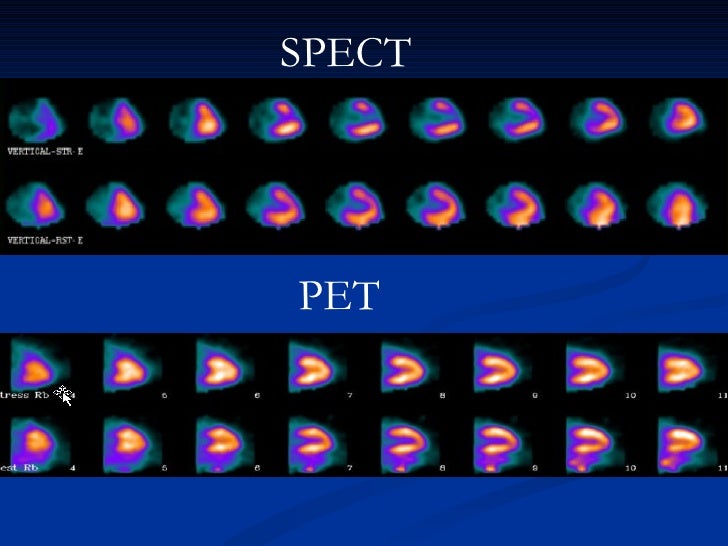 Cardiac Pet Power Point