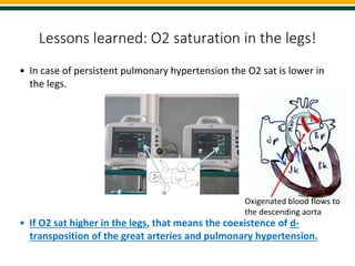 Diagnosis and Management of Cyanosis in a Newborn with Transposition of ...