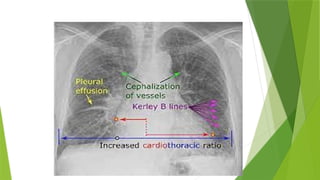 CARDIAC AAREST PRESENTATION .PPT FOR NURSING STUDENT | PPTX
