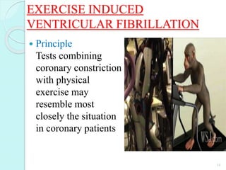 EXERCISE INDUCED
VENTRICULAR FIBRILLATION
 Principle
Tests combining
coronary constriction
with physical
exercise may
resemble most
closely the situation
in coronary patients
14
 