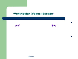 -Ventricular (Vagus) Escape-

                                
 A-V                      S-A



                                




          kamrani
 