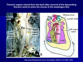 Thoracic organs viewed from the back after removal of the descending
thoracic aorta to show the course of the esophagus (Es)
Sánchez-Quintana D et al. Circulation 2005;112:1400-1405
 