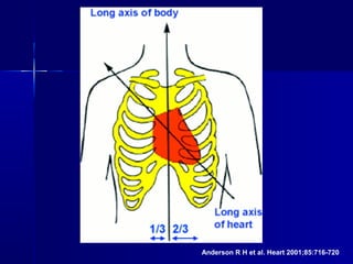 Anderson R H et al. Heart 2001;85:716-720
 