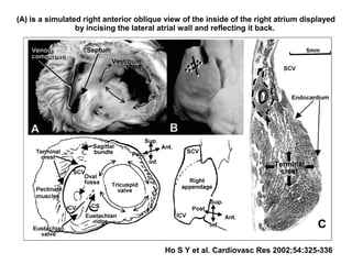 (A) is a simulated right anterior oblique view of the inside of the right atrium displayed
by incising the lateral atrial wall and reflecting it back.
Ho S Y et al. Cardiovasc Res 2002;54:325-336
 