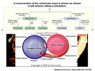 A cross-section of the ventricular mass is shown as viewed
in left anterior oblique orientation.
Anderson R H et al. Heart 2001;85:716-720
 