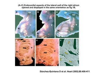 (A–C) Endocardial aspects of the lateral wall of the right atrium
opened and displayed in the same orientation as fig 1B.
Sánchez-Quintana D et al. Heart 2002;88:406-411
 