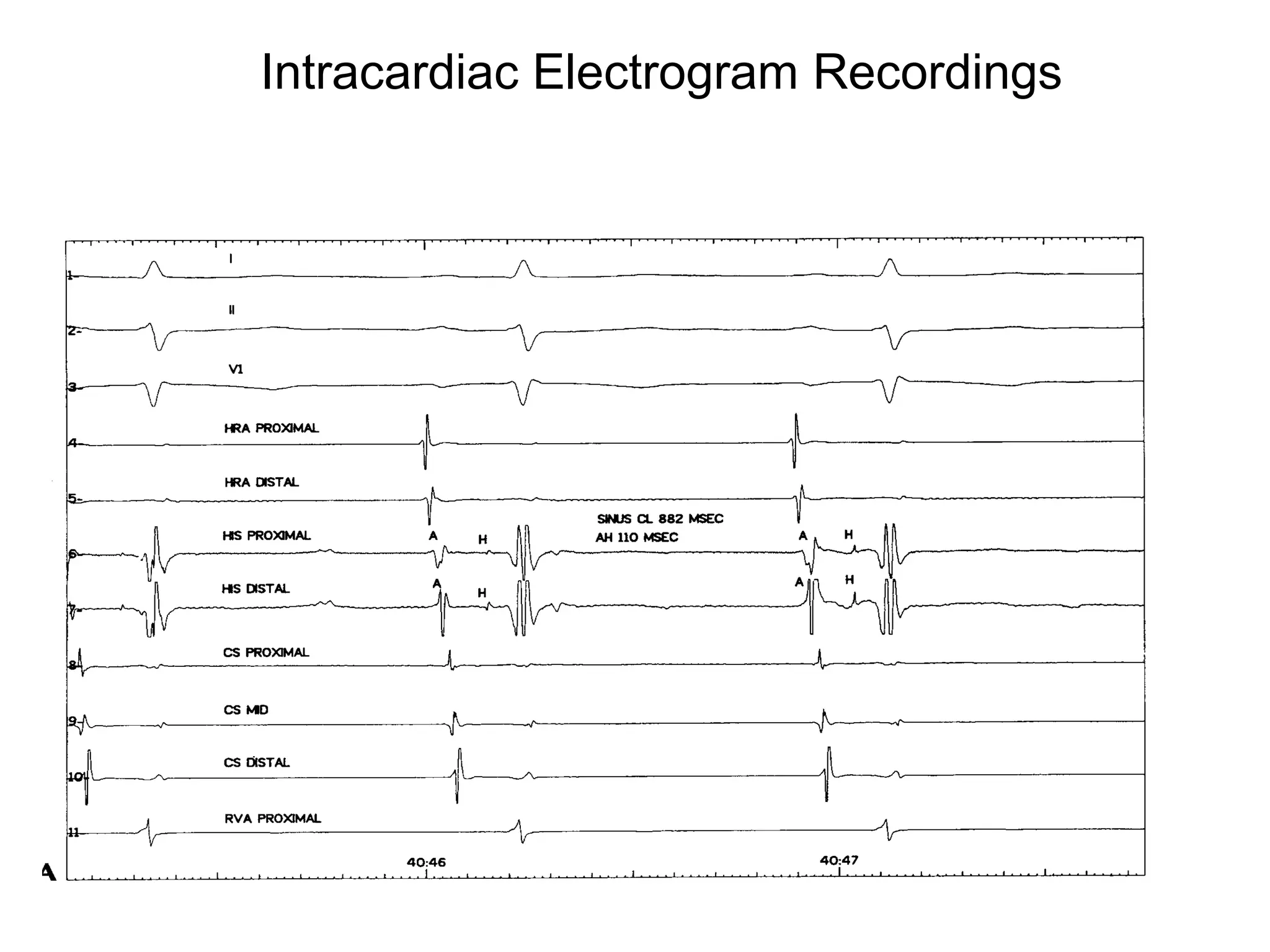 Cardiac Anatomy_20120916_南區 | PPT