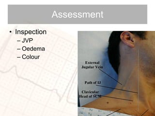 Assessment Inspection JVP Oedema Colour 