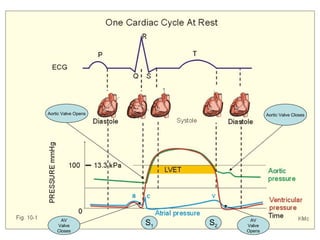 Aortic Valve Opens                     Aortic Valve Closes




      AV                        AV
    Valve            S1   S2   Valve
    Closes                     Opens
 