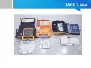 Defibrillation
 