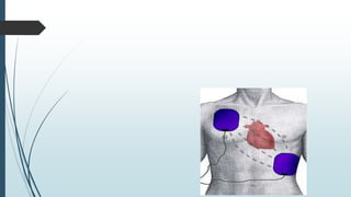 cardiacarrestbsc-200426022233.pdfpptgforbscnyrsing | PDF