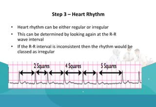 Cardiac Arrest Rhythm.pdf