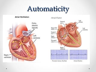 Svt Management Pdf Comprehensive Guide to Supraventricular Tachycardia in Pediatric ...