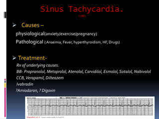 Sinus Tachycardia.
(SND)
 Causes –
physiological(anxiety/exercise/pregnancy)
Pathological ( Anaemia, Fever, hyperthyroidism, HF, Drugs)
 Treatment-
Rx of underlying causes.
BB- Propranolol, Metoprolol, Atenolol, Carvidilol, Esmolol,Sotalol, Nabivolol
CCB,Verapamil, Dilteazem
Ivabradin
?Amiodaron, ? Digoxin
 