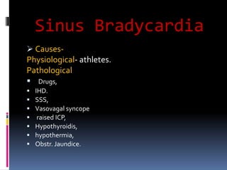 Sinus Bradycardia
 Causes-
Physiological- athletes.
Pathological
 Drugs,
 IHD.
 SSS,
 Vasovagal syncope
 raised ICP,
 Hypothyroidis,
 hypothermia,
 Obstr. Jaundice.
 