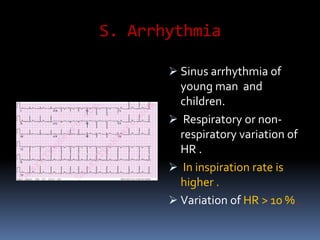 S. Arrhythmia
 Sinus arrhythmia of
young man and
children.
 Respiratory or non-
respiratory variation of
HR .
 In inspiration rate is
higher .
 Variation of HR > 10 % .
*
 