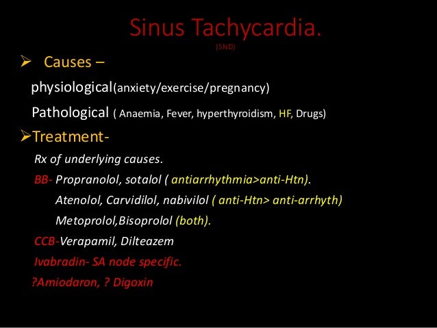 Cardiac Arrhythmia Cardiac Arrhythmia
