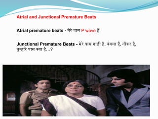 Atrial and Junctional Premature Beats
Atrial premature beats - मेरे पास P wave हैं
Junctional Premature Beats - मेरे पास गाड़ी है, बंगला हैं, नौकर है,
…
तुम्हारे पास क्या है ?
 