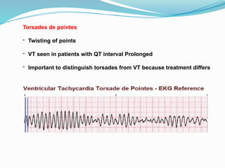 Torsades de pointes
- Twisting of points
- VT seen in patients with QT interval Prolonged
- Important to distinguish torsades from VT because treatment differs
 