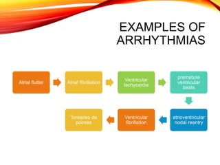 EXAMPLES OF
ARRHYTHMIAS
Atrial flutter Atrial fibrillation
Ventricular
tachycardia
premature
ventricular
beats
atrioventricular
nodal reentry
Ventricular
fibrillation
Torsades de
pointes
 