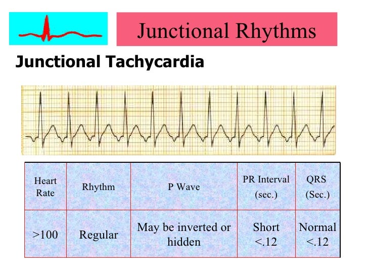 Cardiac arrhythmias