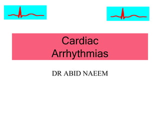 Cardiac
Arrhythmias
DR ABID NAEEM
 