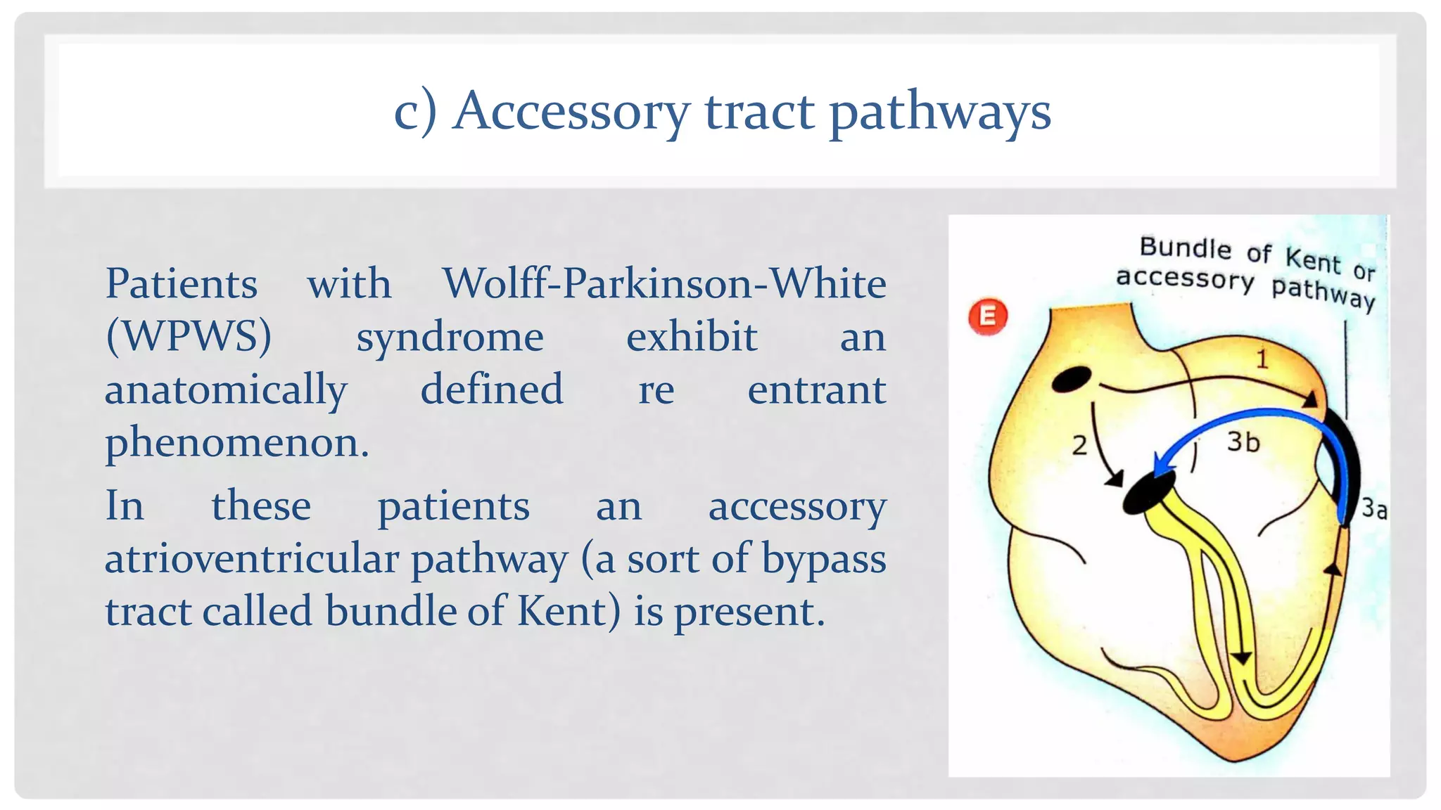 c) Accessory tract pathways
Patients with Wolff-Parkinson-White
(WPWS) syndrome exhibit an
anatomically defined re entrant
phenomenon.
In these patients an accessory
atrioventricular pathway (a sort of bypass
tract called bundle of Kent) is present.
 