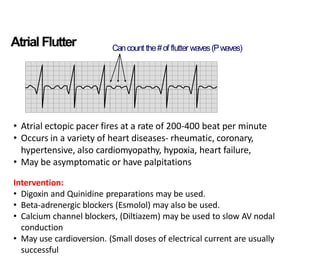 Cardiac Arrhythmias (2).pdf for nursing student | PDF