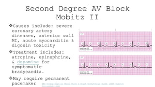 Cardiac Arrhythmias and aortic-anesurism.pptx