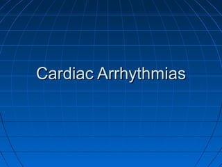 Cardiac ArrhythmiasCardiac Arrhythmias
 