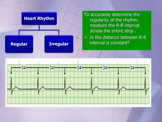 Heart Rhythm
Regular Irregular
To accurately determine the
regularity of the rhythm,
measure the R-R interval
across the entire strip .
 Is the distance between R-R
interval is constant?
 