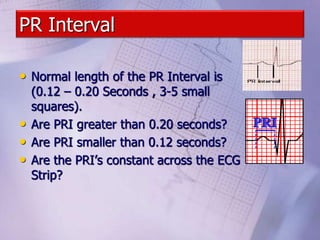 PR Interval
• Normal length of the PR Interval is
(0.12 – 0.20 Seconds , 3-5 small
squares).
• Are PRI greater than 0.20 seconds?
• Are PRI smaller than 0.12 seconds?
• Are the PRI’s constant across the ECG
Strip?
 