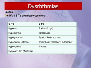 Dysrhthmias
Causes:
6 H’s & 5 T’s are mostly common:
6 H’s 5 T’s
Hypoxia Toxins (Drugs).
Hypothermia Tamponade
Hypoglycemia Tension Pneumothorax
Hypo/hyper kalemia Thrombosis (coronary, pulmonary)
Hypovolemia Trauma
Hydrogen Ion (Acidosis)
 