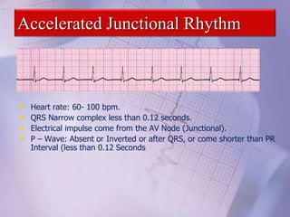 Accelerated Junctional Rhythm
• Heart rate: 60- 100 bpm.
• QRS Narrow complex less than 0.12 seconds.
• Electrical impulse come from the AV Node (Junctional).
• P – Wave: Absent or Inverted or after QRS, or come shorter than PR
Interval (less than 0.12 Seconds
 