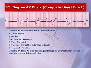 3rd Degree AV Block (Complete Heart Block)
• Complete AV disassociation, HR is a ventricular rate
• Rhythm - Regular
• Rate - Slow
• QRS Duration - Prolonged
• P Wave - Unrelated
• P Wave rate - Normal but faster than QRS rate
• P-R Interval - Variation
• Complete AV block. No atrial impulses pass through the atrioventricular node and the
ventricles generate their own rhythm
 