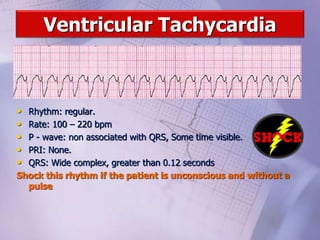 Ventricular Tachycardia
• Rhythm: regular.
• Rate: 100 – 220 bpm
• P - wave: non associated with QRS, Some time visible.
• PRI: None.
• QRS: Wide complex, greater than 0.12 seconds
Shock this rhythm if the patient is unconscious and without a
pulse
 